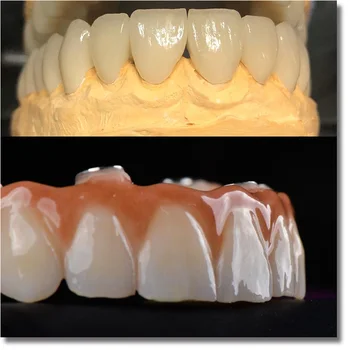 UT ekstremalių 9812mm geriausią estetinį poveikį, cirkonio dantų blokai dantų lab